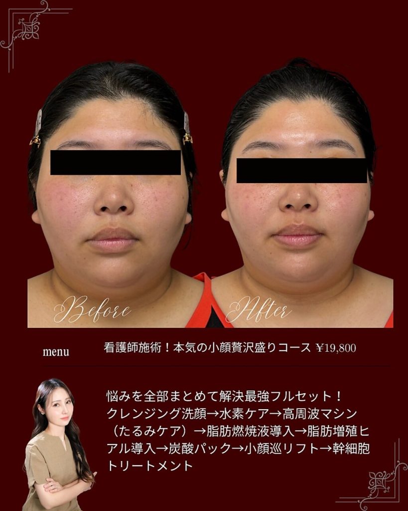 小顔への道しるべ